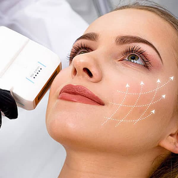 HIFU treatment in Melbourne: lift and firm skin without surgery